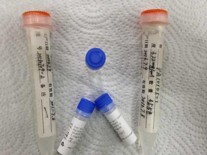 Anti- anticorps monoclonal d'hybridome de Mab de souris de HBcAg pour la fabrication d'IVD