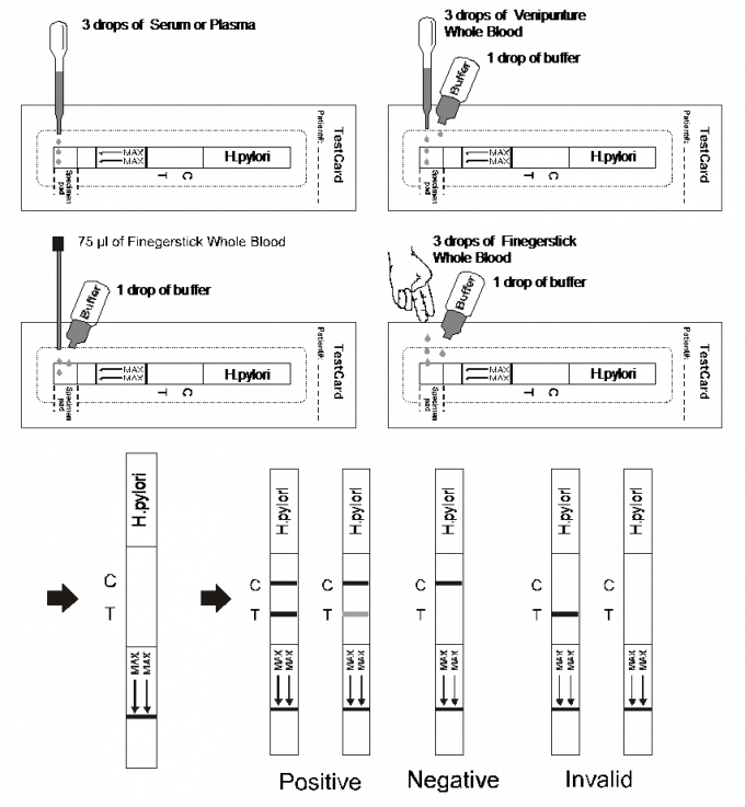 L'écoulement latéral Immunochromatographic d'anticorps de H.pylori analyse des bandes, sang total/sérum/plasma