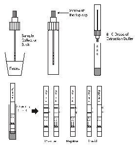 Analyses latérales d'Immunochromatographic d'écoulement de jaugeur rapide d'essai d'antigène de H.Pylori