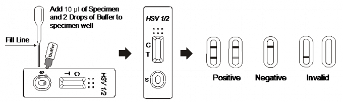 L'écoulement latéral Immunochromatographic analyse la cassette rapide d'essai de HSV 1/2 IgG pour le sérum ou le plasma