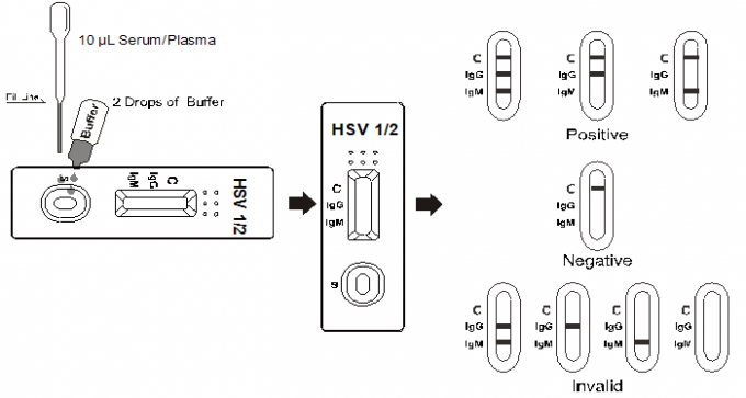 HSV 1/2 IgG/immunoessai chromatographique essai d'IgM d'écoulement latéral rapide de cassette