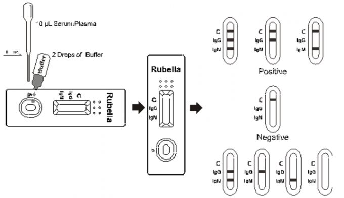 Kits rapides d'essai d'AllTest pour la détection qualitative des anticorps d'IgG et d'IgM à la rubéole