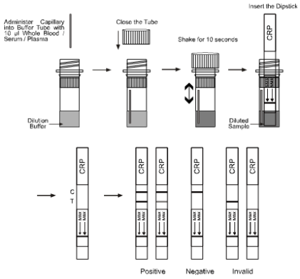 Immunoessai chromatographique rapide diagnostique d'analyses de sang de jaugeur rapide d'essai de CRP