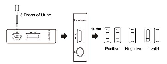 Streptocoque cassette rapide d'essai d'antigène de Pneumoniae, analyse d'urine rapide