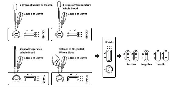 99,6% Kits rapides d'essai de l'exactitude CK-MB un diagnostic d'étape dans un délai de 10 minutes