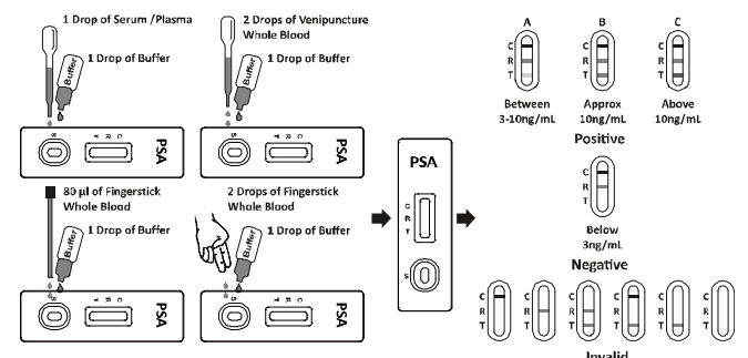 Kits de sérum sanguin entier/essai du plasma PSA pour le laboratoire clinique/à la maison rapides