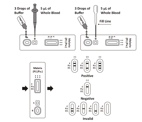 Malaria P.f. /P.v. Cassette rapide d'essai, essai rapide de diagnostic