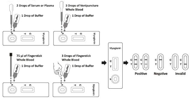 Cassette d'essai d'infarctus du myocarde de diagnostic