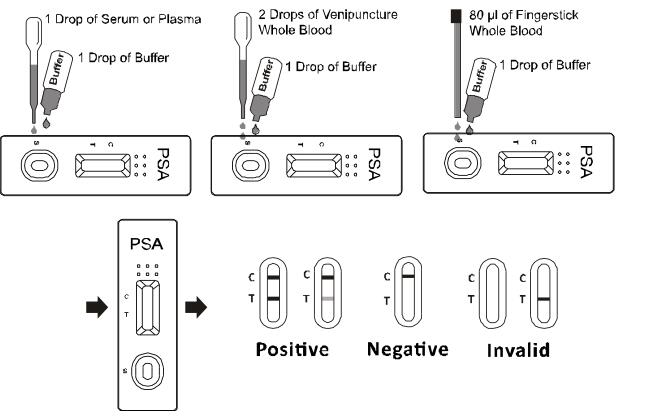 Kits rapides qualitatifs d'essai de (PSA) d'antigène spécifique de prostate de diagnostic médical pour le risque de cancer de la prostate avec CE0123