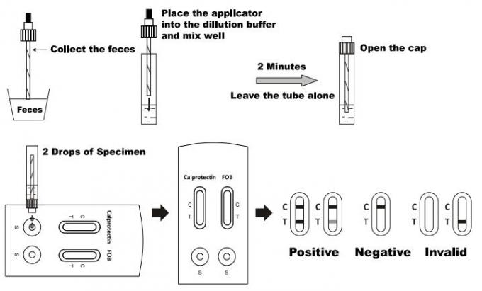 Lecture rapide Calprotectin précis sensible et étape rapide FOB de la cassette une d'essai jetable pour le diagnostic avec du CE