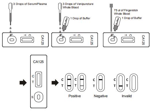cassette rapide précise extrêmement sensible rapide d'essai de l'étape CA-125 de lecture une jetable pour le diagnostic avec du CE