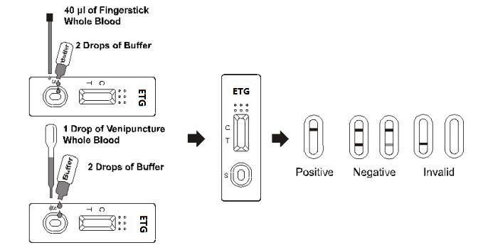 essai 500ng rapide à la détection de l'alcool Glucuronide éthylique dans le sang total humain /Serum/Plasma avec du CE