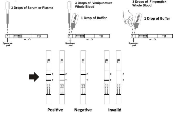 Maladie infectieuse de TB de tuberculose de jaugeur de bande examinant les kits rapides avec du CE