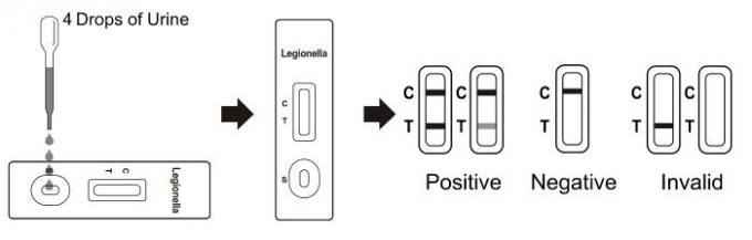 Cassette rapide d'essai de pneumophila de Legionella (urine)