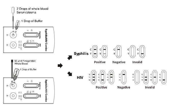 Sang total/sérum/plasma rapides combinés de haute qualité de cassette d'essai de Syphilis/HIV 1.2.O