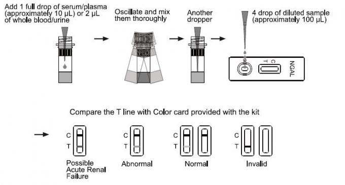 Essai rapide gélatinase-associé de Rapid d'étape de la cassette une d'essai du lipocalin de neutrophile (NGAL)