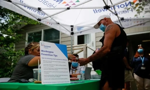 Latest company news about Réponse lente aux agences de santé des États-Unis d'expositions de Monkeypox comme « fatiguées, surchargé »