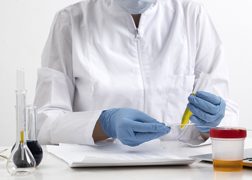 Dernières nouvelles de l'entreprise Que révèle l'urine sur votre santé?