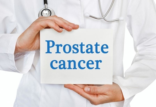 Dernières nouvelles de l'entreprise Le cancer de la prostate: une préoccupation croissante pour la santé des hommes dans le monde