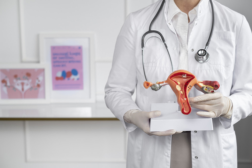 Dernières nouvelles de l'entreprise L'endométriose est fortement liée à un risque accru de cancer de l'ovaire