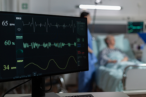 Dernières nouvelles de l'entreprise Comprendre la fibrillation auriculaire (FA)
