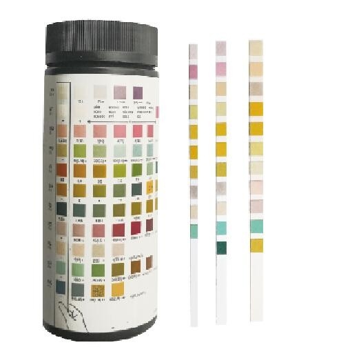 Latest company news about Que ne devrait pas apparaître en urine après une analyse d'urine ?