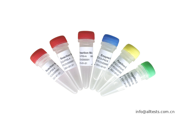 Good price Analyse en temps réel d'Allchek SARS-COV-2 droite Qpcr en ligne